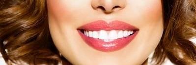 A woman with veneers smiling