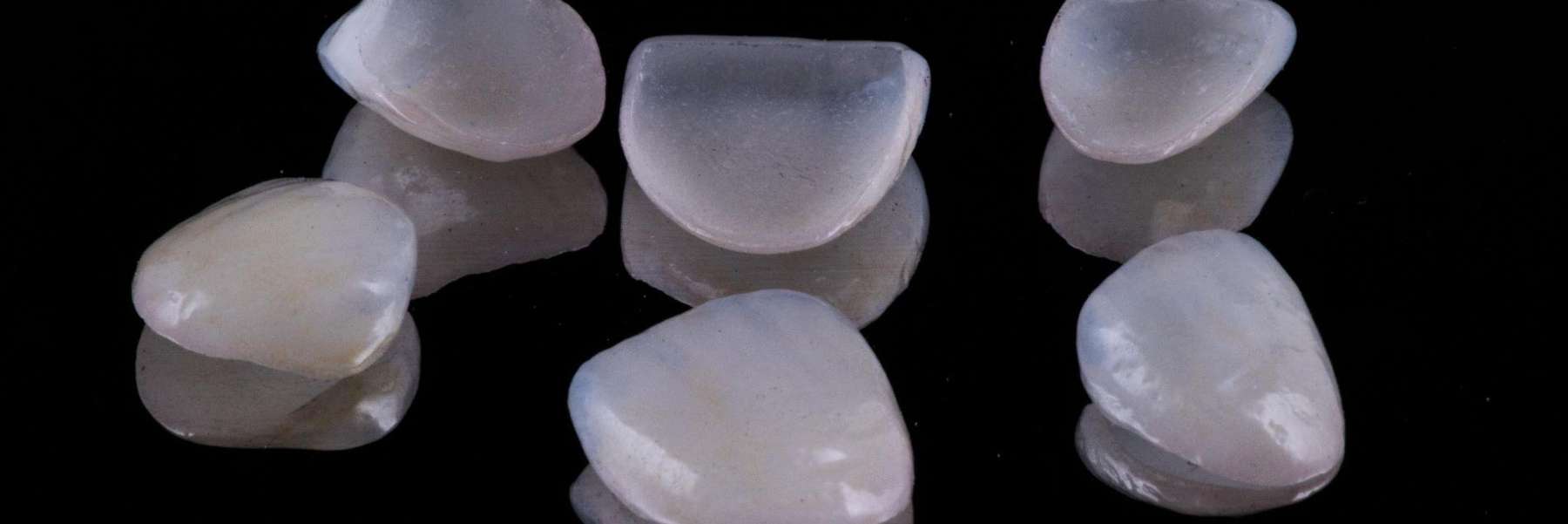 Porcelain Veneers | dentist East Vancouver