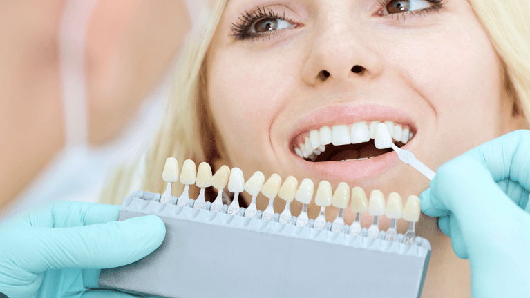 A woman comparing shades of dental veneers