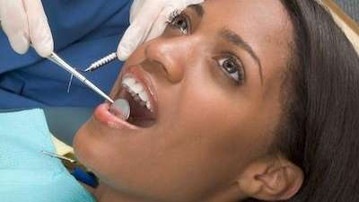 A woman getting a dental exam | dentist Vancouver, BC