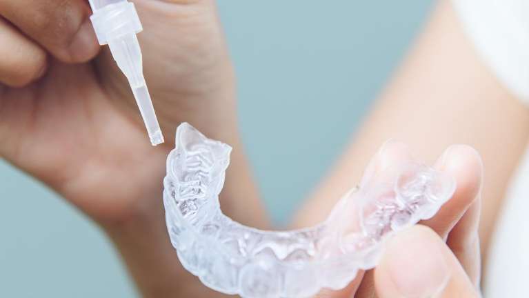 A whitening tray and whitening gel in Vancouver