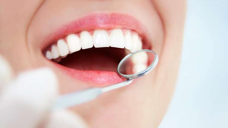 A smiling woman with a dental mirror