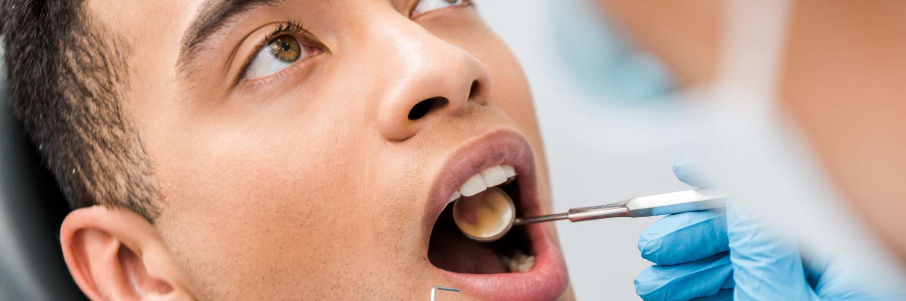 A man getting a dental exam | dentist vancouver