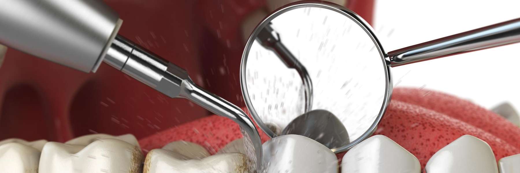 close up of dental tool and mirror working on teeth