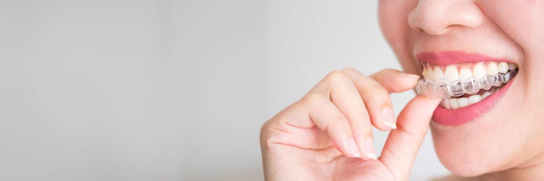 woman using invisalign in east vancouver